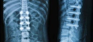 рентгенова снимка-на гърба