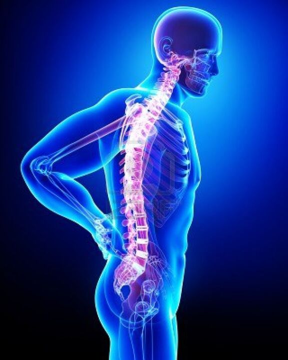 Човешки гръбначен стълб, засегнат от остеохондроза