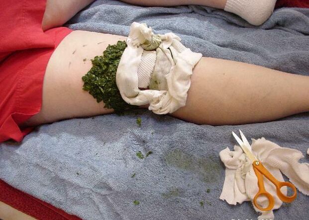 Топъл компрес от натрошени зелеви листа върху болна колянна става при артроза